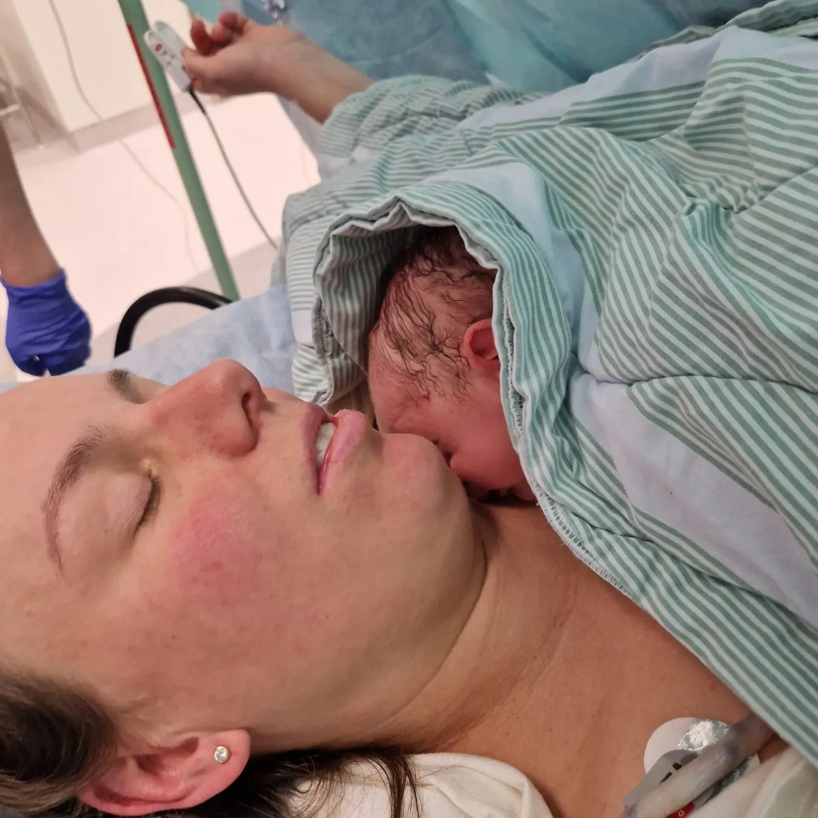 Sara vilar med sin nyfödda son hud mot hud efter kejsarsnittet.